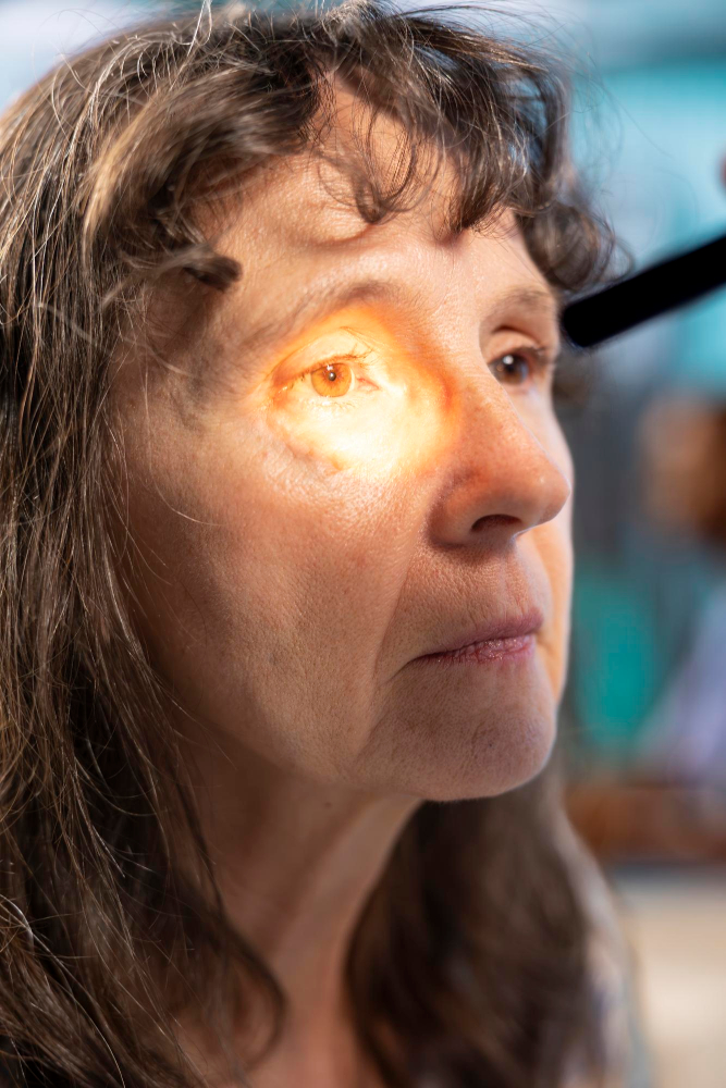 Krwotok do ciała szklistego vitreous hemorrhage Lublin